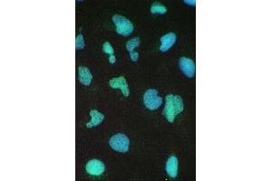 IF analysis of BRG1 using anti-BRG1 antibody (ABIN5692863) BRG1 was detected in immunocytochemical section of U20S cell.