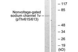 Western blot analysis of extracts from HeLa cells, using Nonvoltage-gated Sodium Channel 1 (Phospho-Thr615) Antibody. (Nonvoltage-Gated Sodium Channel 1 (AA 581-630), (pThr615) antibody)