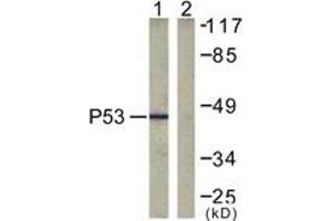 Western blot analysis of extracts from COS7 cells, treated with TSA 400nM 24h, using p53 (Ab-317) Antibody. (p53 antibody  (AA 283-332))