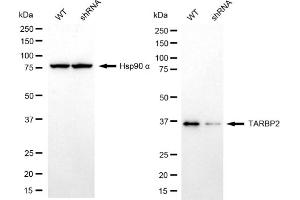 Western blotting analysis using TARBP2 antibody (ABIN7800510).