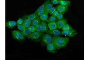 IF analysis of NSE using anti-NSE antibody (ABIN6719549). (ENO2/NSE antibody)