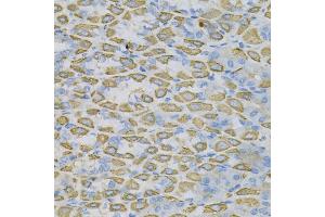 Immunohistochemistry (IHC) image for anti-Ephrin A1 (EFNA1) (AA 19-182) antibody (ABIN6139961)