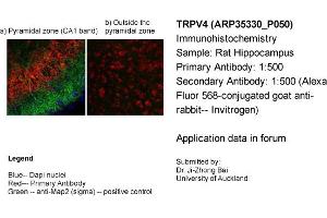 Immunohistochemistry (IHC) image for anti-Transient Receptor Potential Cation Channel, Subfamily V, Member 4 (TRPV4) (Middle Region) antibody (ABIN501396) (TRPV4 antibody  (Middle Region))