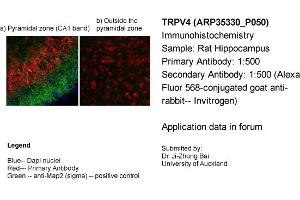 Immunohistochemistry (IHC) image for anti-Transient Receptor Potential Cation Channel, Subfamily V, Member 4 (TRPV4) (Middle Region) antibody (ABIN2776240) (TRPV4 antibody  (Middle Region))