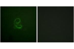 Immunofluorescence analysis of A549 cells, using IL-4R/CD124 (Ab-497) Antibody. (IL4 Receptor antibody  (AA 463-512))