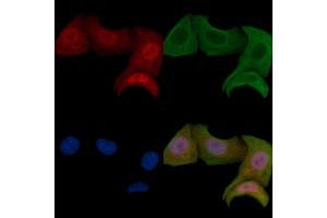 ABIN6255699 and ABIN6267466 staining Hela cells by IF/ICC.
