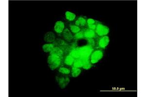 Immunofluorescence of monoclonal antibody to ITGB3BP on A-431 cell. (ITGB3BP antibody  (AA 1-100))