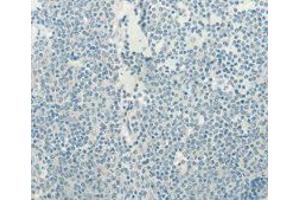 Immunohistochemistry (IHC) image for anti-Telomerase Reverse Transcriptase (TERT) antibody (ABIN1875058) (TERT antibody)