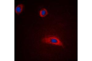 Immunofluorescent analysis of GAP43 staining in HeLa cells.
