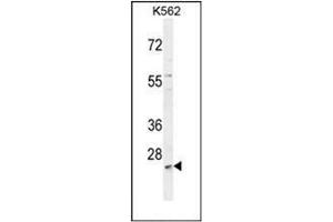 Western blot analysis of MCART2 Antibody (N-term) in K562 cell line lysates (35ug/lane).