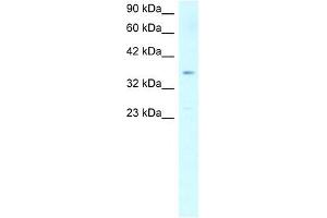 SCD antibody used at 1 ug/ml to detect target protein. (SCD antibody)