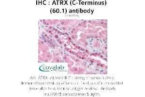 Image no. 1 for anti-RAD54-Like (RAD54L) (AA 1-300) antibody (ABIN1723093) (RAD54L antibody  (AA 1-300))