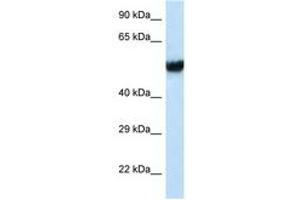 Image no. 1 for anti-Intraflagellar Transport Protein 74 Homolog (IFT74) (C-Term) antibody (ABIN6747643) (IFT74 antibody  (C-Term))