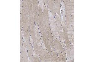Immunohistochemical analysis of A on paraffin-embedded Human skeletal muscle tissue. (RAPTOR antibody  (pSer863))