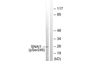 Western blot analysis of extracts from HT29 cells, using SNAI1 (Phospho-Ser246) antibody. (SNAIL antibody  (pSer246))