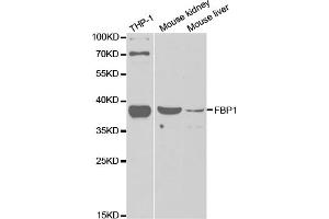 Western blot analysis of extracts of various cell lines, using FBP1 antibody (ABIN5973135) at 1/1000 dilution. (FBP1 antibody)