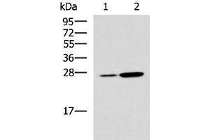 Western blot analysis of Mouse kidney tissue and Mouse liver tissue lysates using NQO2 Polyclonal Antibody at dilution of 1:1000 (NQO2 antibody)