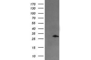 Image no. 1 for anti-Snail Family Zinc Finger 2 (SNAI2) antibody (ABIN1502651) (SLUG antibody)
