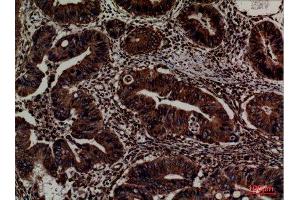 Immunohistochemistry (IHC) image for anti-Protein Disulfide Isomerase Family A, Member 3 (PDIA3) (Internal Region) antibody (ABIN6280937)
