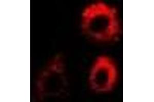 Immunofluorescent analysis of PTRH2 staining in MCF7 cells. (PTRH2 antibody)