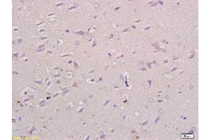 Formalin-fixed and paraffin embedded rat brain tissue labeled with Anti-NPRB/Natriuretic Peptide Receptor B Polyclonal Antibody, Unconjugated (ABIN679778) at 1:200 followed by conjugation to the secondary antibody (NPR2 antibody  (AA 101-200))