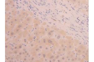 IHC-P analysis of Human Liver Tissue, with DAB staining. (ALT antibody  (AA 367-480))