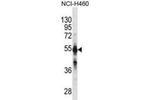 Western Blotting (WB) image for anti-Cytochrome P450, Family 2, Subfamily C, Polypeptide 9 (CYP2C9) antibody (ABIN2897857) (CYP2C9 antibody)
