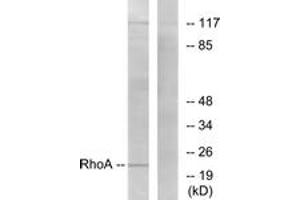 Western blot analysis of extracts from HepG2 cells, using RhoA (Ab-188) Antibody. (RHOA antibody  (AA 144-193))