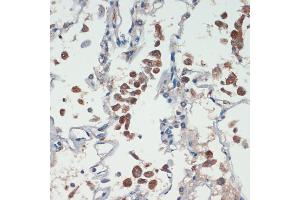 Immunohistochemistry of paraffin-embedded human lung using APC antibody (ABIN1678689, ABIN1678690, ABIN5664154 and ABIN6219837) at dilution of 1:200 (40x lens). (APC antibody  (AA 2544-2843))
