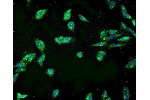 IF analysis of APPL1 using anti-APPL1 antibody (ABIN7602658).