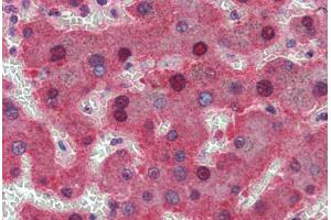 Human Liver: Formalin-Fixed, Paraffin-Embedded (FFPE) (c-MYC antibody  (AA 408-439))