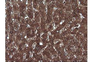 Image no. 4 for anti-Melan A (MLANA) antibody (ABIN1499425) (MLANA antibody)