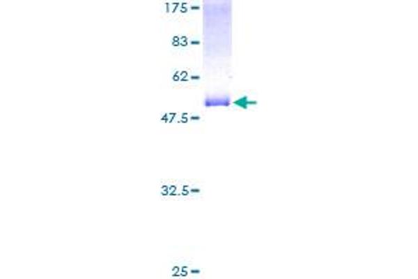 Reticulon 3 Protein (RTN3) (AA 1-236) (GST tag)