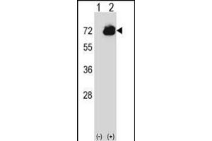 Western blot analysis of CTPS2 (arrow) using rabbit polyclonal CTPS2 Antibody (C-term) (ABIN656954 and ABIN2846140). (CTPS2 antibody  (C-Term))