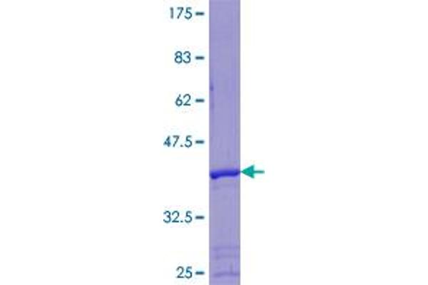 SHFM1 Protein (AA 1-70) (GST tag)