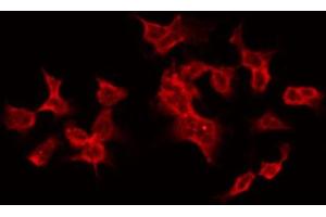 ABIN6268846 staining HT29 by IF/ICC. (TANK antibody  (Internal Region))