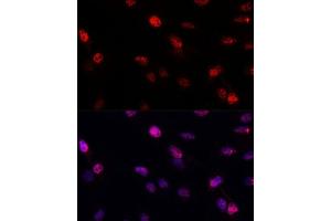 Immunofluorescence analysis of C6 cells using BRC antibody (1318) at dilution of 1:100. (BRCA1 antibody  (AA 400-699))