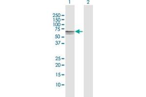 Western Blot analysis of DOK1 expression in transfected 293T cell line by DOK1 MaxPab polyclonal antibody. (DOK1 antibody  (AA 1-481))