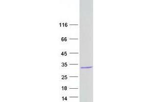 Chromosome 6 Open Reading Frame 62 (C6ORF62) protein (Myc-DYKDDDDK Tag)