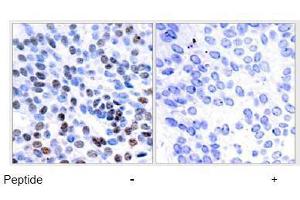 Image no. 1 for anti-Jun B Proto-Oncogene (JUNB) (Ser259) antibody (ABIN197140) (JunB antibody  (Ser259))