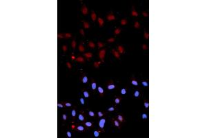 Immunofluorescence analysis of U2OS cells using Phospho-Stat3-Y705 antibody (ABIN5969916). (STAT3 antibody  (pTyr705))