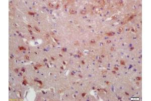 Formalin-fixed and paraffin embedded rat brain labeled with Anti-MRF/C11orf9 Polyclonal Antibody, Unconjugated (ABIN1386454) at 1:200 followed by conjugation to the secondary antibody and DAB staining (Chromosome 11open Reading Frame 9 (C11orf9) (AA 401-500) antibody)