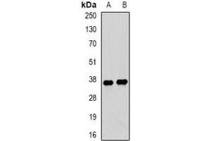 Western blot analysis of Tropomyosin 3 expression in mouse lung (A), mouse heart (B) whole cell lysates. (TPM3 antibody)
