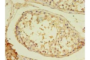 Immunohistochemistry of paraffin-embedded human testis tissue using ABIN7160592 at dilution of 1:100 (MYH7B antibody  (AA 1-176))