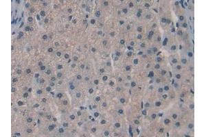 Detection of SPRY3 in Human Liver Tissue using Polyclonal Antibody to Sprouty Homolog 3 (SPRY3) (SPRY3 antibody  (AA 91-288))