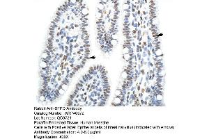 Rabbit Anti-SFPQ Antibody  Paraffin Embedded Tissue: Human Intestine Cellular Data: Epithelial cells of intestinal villas Antibody Concentration: 4. (SFPQ antibody  (N-Term))