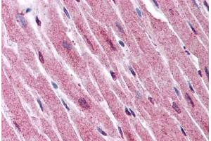 Human Heart (formalin-fixed, paraffin-embedded) stained with ADAMTS4 antibody ABIN290074 at 2. (ADAMTS4 antibody  (Internal Region))