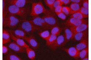 IF analysis of RPS15A using anti-RPS15A antibody (ABIN7598954). (RPS15A antibody  (AA 1-113))