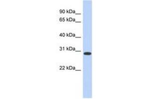 Image no. 1 for anti-Homeobox D12 (HOXD12) (AA 179-228) antibody (ABIN6742239)