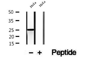 CHCHD6 antibody  (Internal Region)